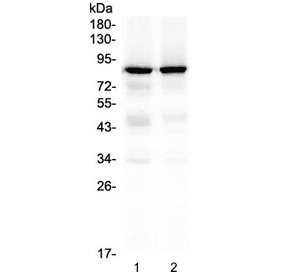Polyclonal Rabbit anti-Human PRKCG / PKC-Gamma Antibody (IHC, WB)