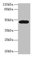 Polyclonal Rabbit anti-Human LIPA / Lysosomal Acid Lipase Antibody (aa22-399, WB)