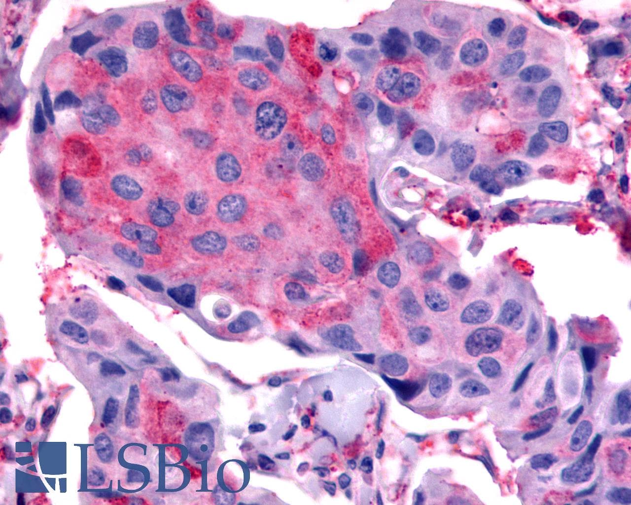 IHC-plus™ Polyclonal Rabbit anti-Human FZD2 / Frizzled 2 Antibody (N-Terminus, IHC)