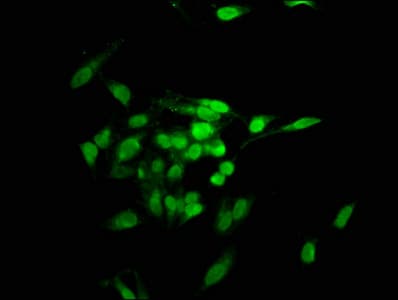 Polyclonal Rabbit anti-Human TNKS1BP1 / TAB182 Antibody (IHC, IF)