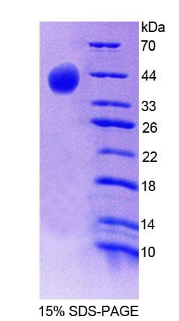 Mouse SYN2 / Synapsin II Protein (Recombinant His-T7, N-terminus)