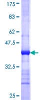 Human CLEC1B / CLEC-2 Protein (Recombinant GST, N-terminus)