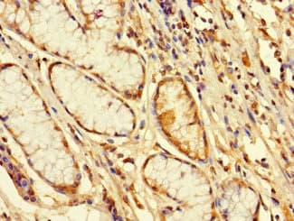 Polyclonal Rabbit anti-Human FBXW12 Antibody