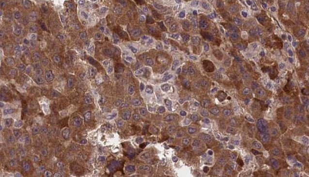 GLRA1/Glycine Receptor Alpha 1 Antibody