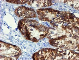 DOK7 Antibody (clone OTI5G8)