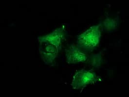 BCAR1 / p130Cas Antibody (clone OTI1A9)