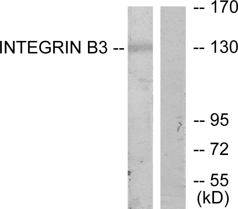 ITGB3 / Integrin Beta 3 / CD61 Antibody (aa731-780)