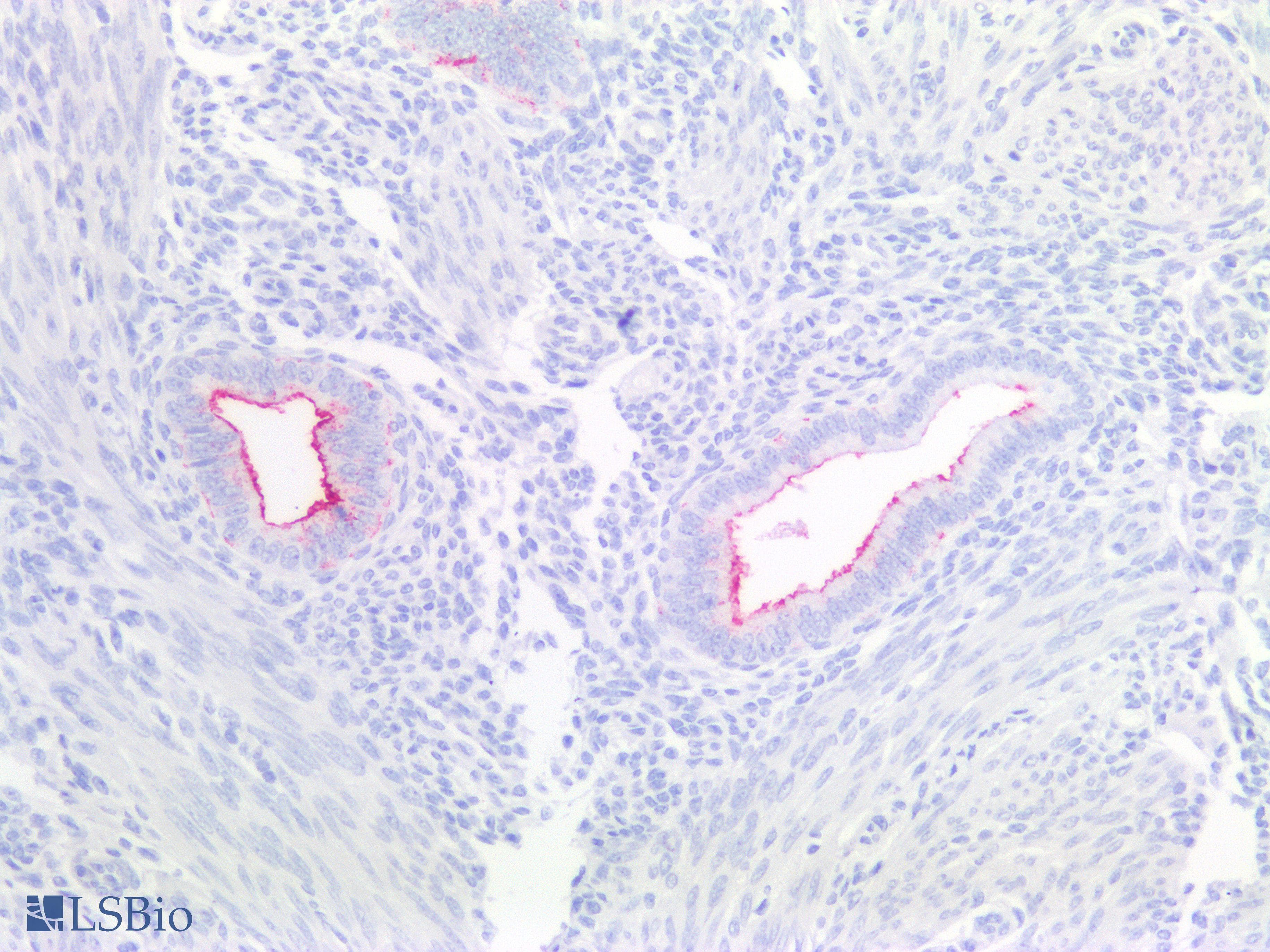 IHC-plus™ Monoclonal Mouse anti-Human CA125 Antibody (Concentrated, IHC)