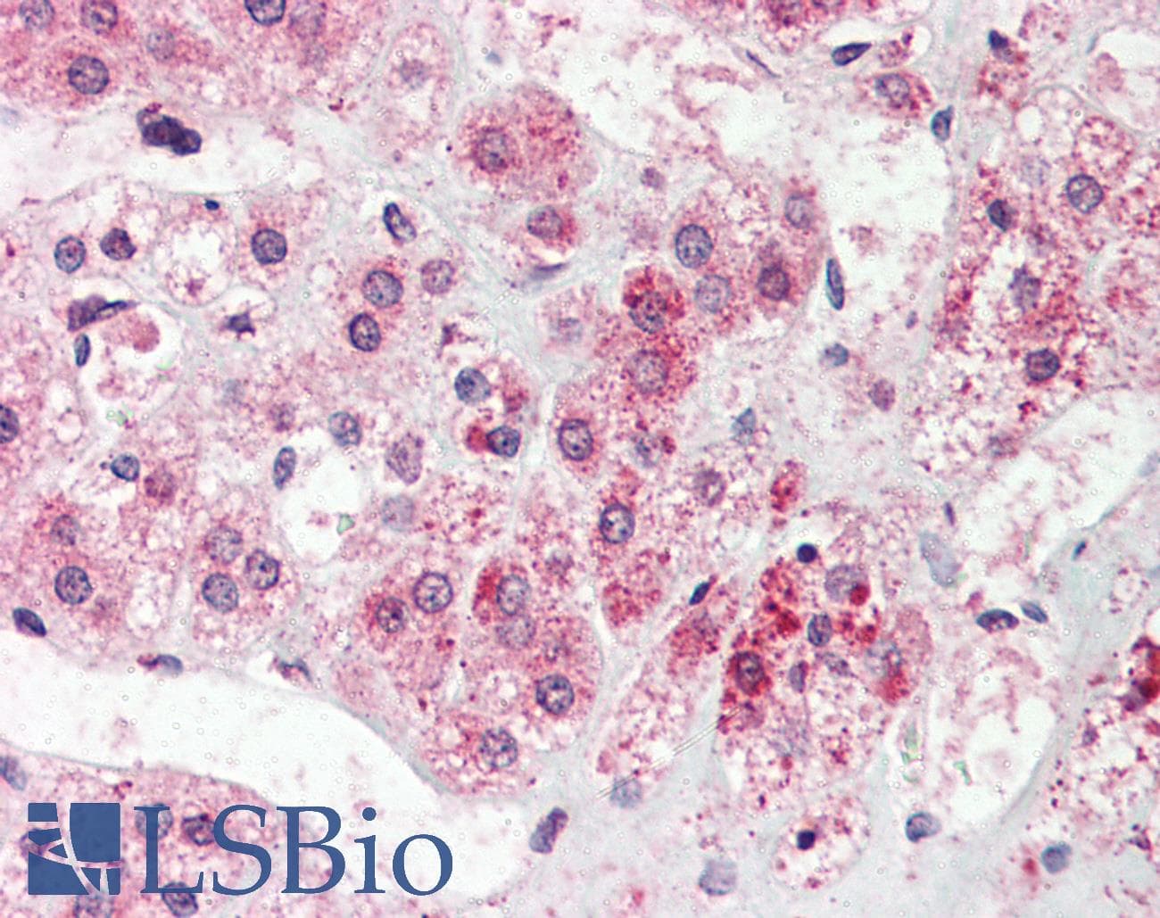 IHC-plus™ Polyclonal Rabbit anti-Human NEK9 Antibody (Pro/Ser/Thr Rich Domain, IHC)