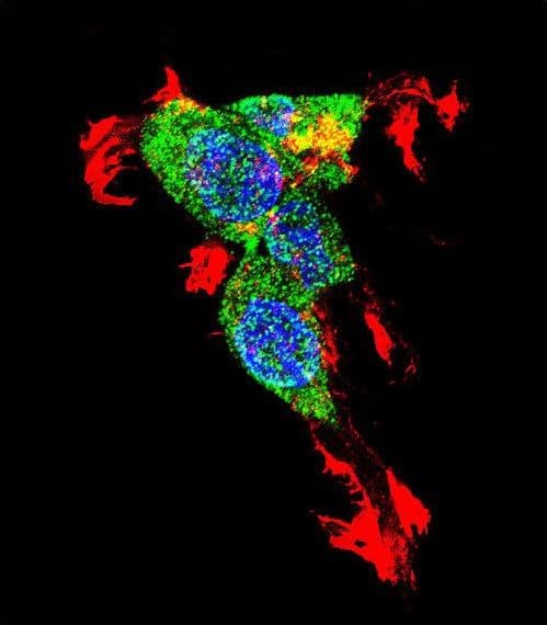 IHC-plus™ CTNNB1 / Beta Catenin Antibody (aa78-106)