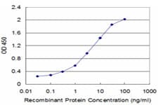 IHC-plus™ CAPZB / CAPZ Beta Antibody (clone 1H1)