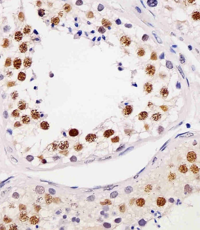 Monoclonal Mouse anti-Human TERF2IP / RAP1 Antibody (clone 1664CT768.14.43, IHC, WB)
