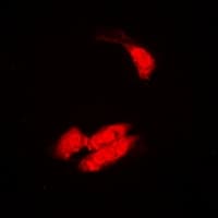 SULT2B1 / Sulfotransferase 2B1 Antibody