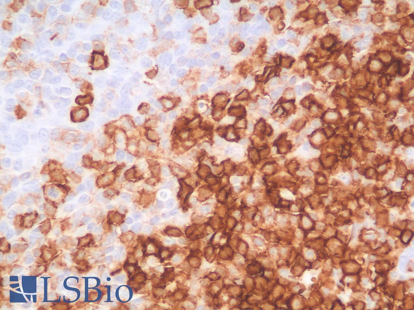 PathPlus™ SPN / CD43 Antibody (clone SPN/2049R)