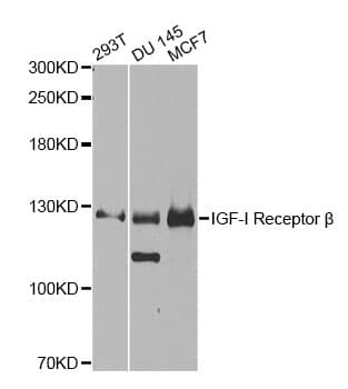 IGF1R / IGF1 Receptor Antibody