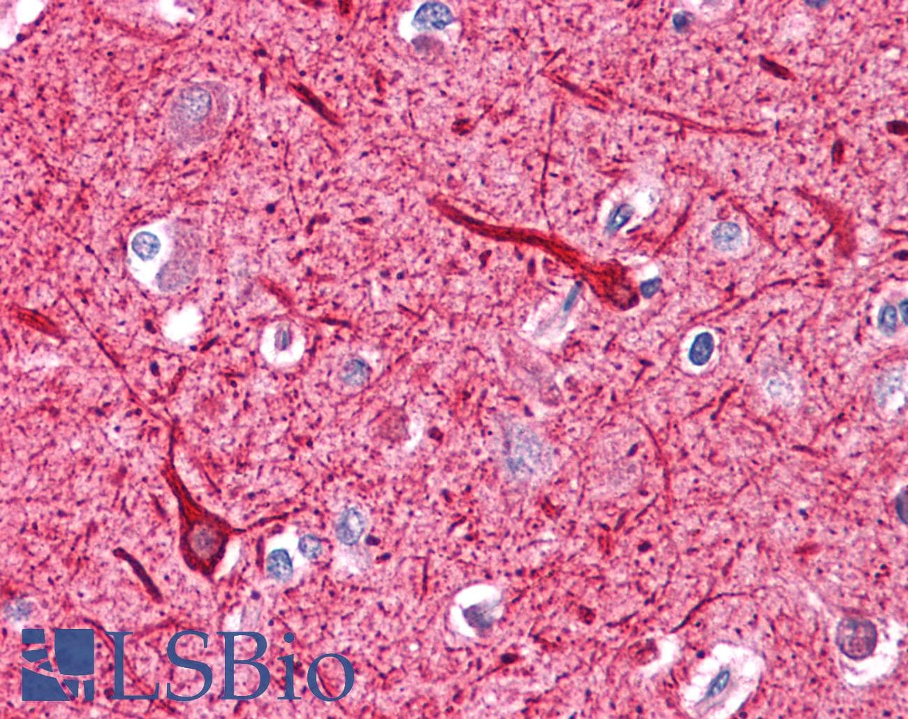 IHC-plus™ Monoclonal Mouse anti-Human NEFH / NF-H Antibody (clone NF-05, IHC, WB)