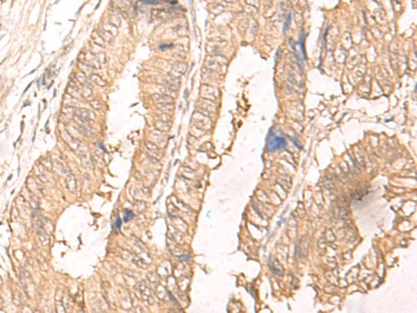IL24 Antibody