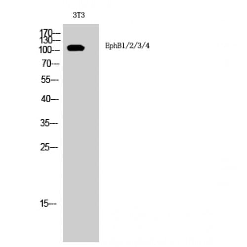 EPHB1 + EPHB2 + EPHB3 + EPHB4 Antibody (540-620 aa)