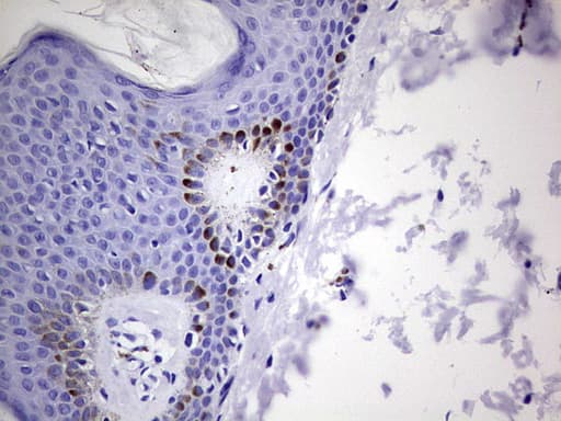 GLI / GLI1 Antibody (aa755-1106, clone OTI1C1)