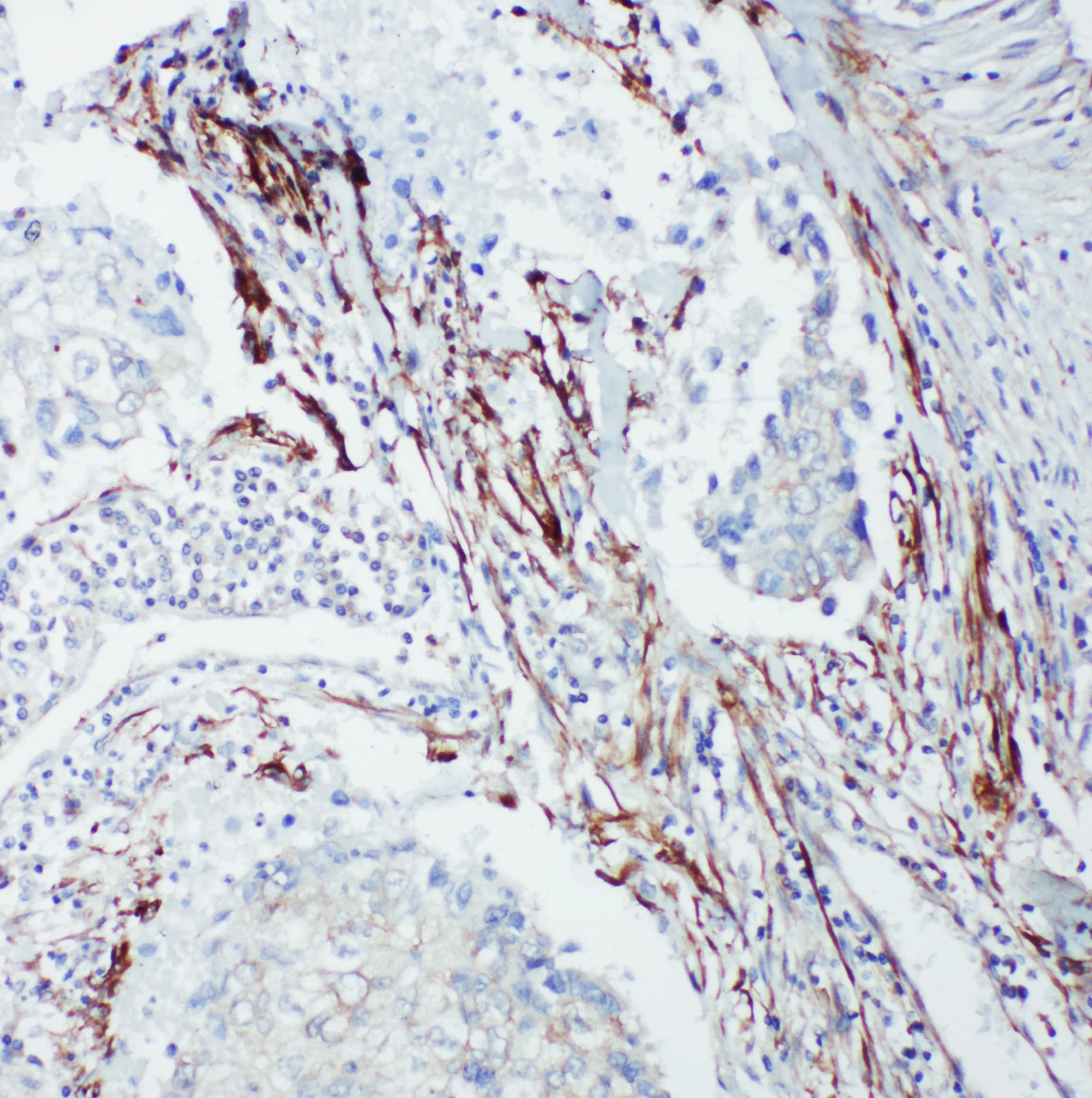 Polyclonal Rabbit anti-Human p66 / SHC Antibody (aa424-440, IHC, WB)