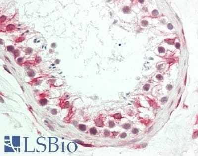 IHC-plus™ GP6 / GPVI Antibody (aa309-337)