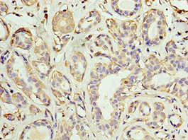 AKAP10 Antibody (aa413-662)