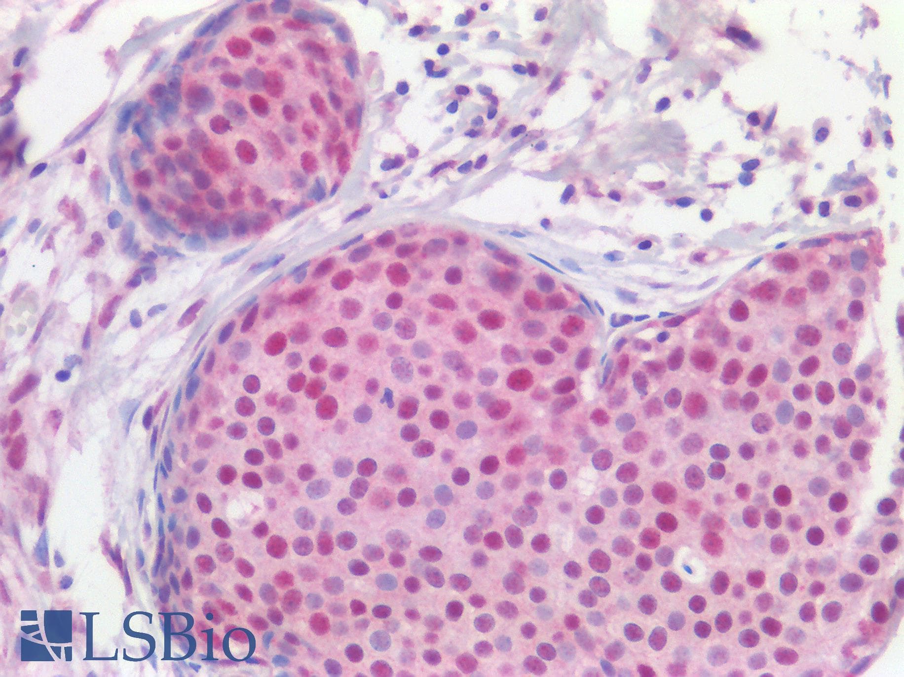PathPlus™ ER Alpha / Estrogen Receptor Antibody