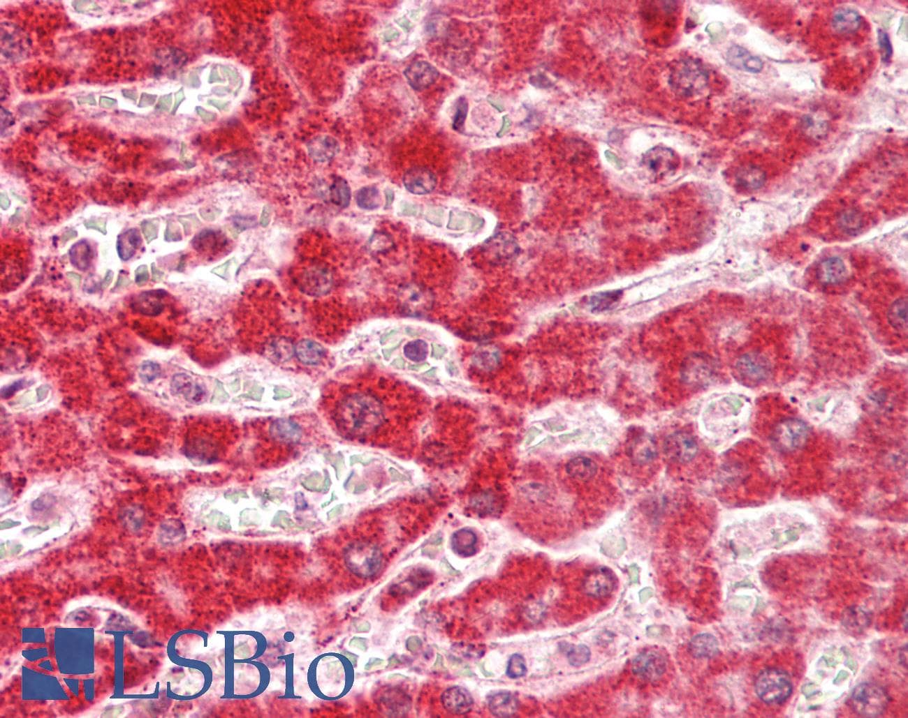 ARHGAP1 / CDC42GAP Antibody (N-Terminus)