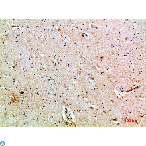 Polyclonal Rabbit anti-Human MIB1 Antibody (WB)