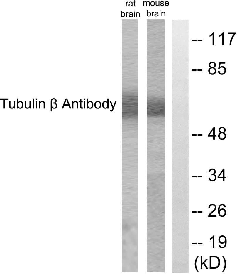 PathPlus™ Polyclonal Rabbit anti-Human TUBB / Beta Tubulin Antibody (aa401-450, IHC, WB)