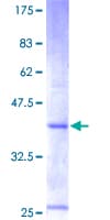 Human CXCL6 Protein (Recombinant GST)
