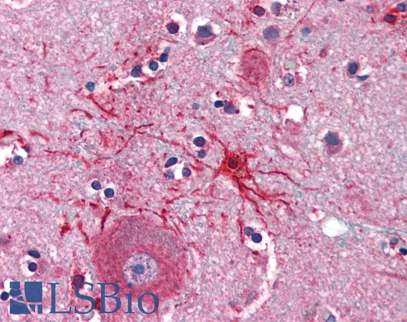 IHC-plus™ APAF1 / APAF-1 Antibody (C-Terminus)