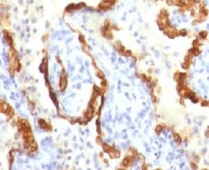 KRT18 / CK18 / Cytokeratin 18 Antibody (clone CTKN18-1)