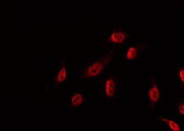 DBF4 Antibody