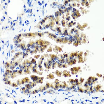 SIRT1 / Sirtuin 1 Antibody
