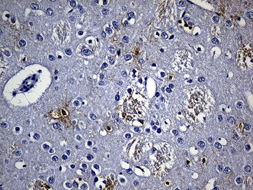 GPR17 Antibody (C-Terminus, clone OTI6A3)