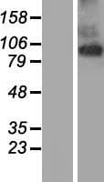 TMEM63A Protein (Over-Expression Lysate Myc-DDK (Flag))