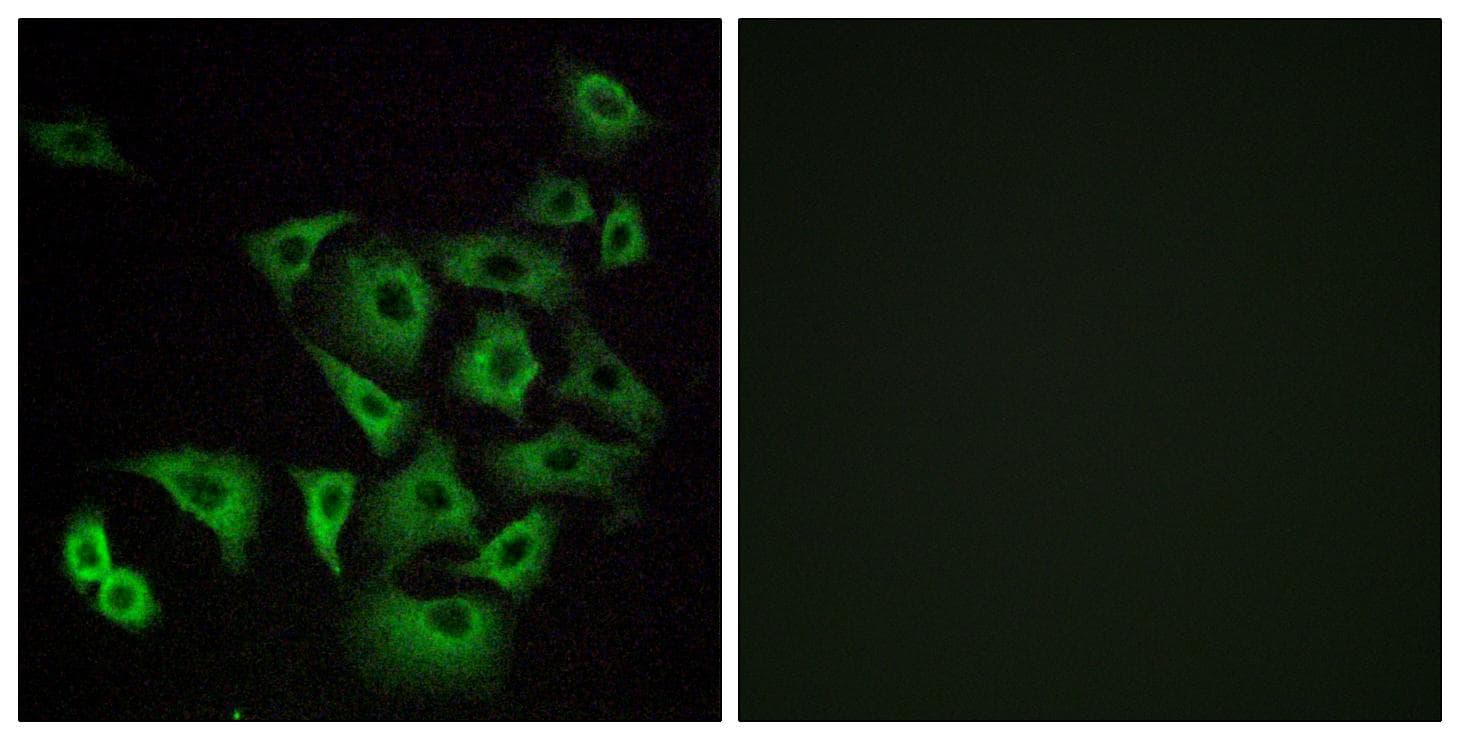 OR4K14 Antibody
