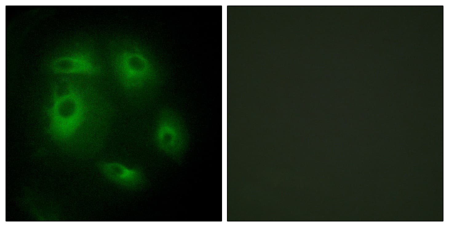 DLEC1 / DLC1 Antibody (aa1-50)