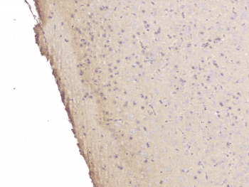SRCIN1 / SNIP Antibody