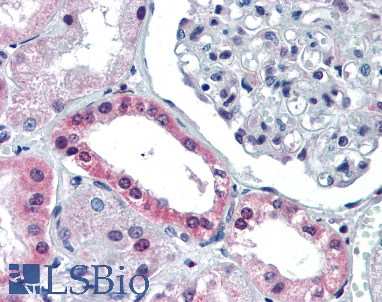 Polyclonal Rabbit anti-Human PAX4 Antibody (aa166-215, IHC, WB)