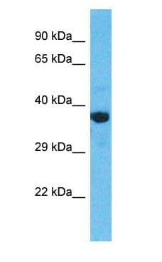 OR2M2 Antibody (aa271-320)