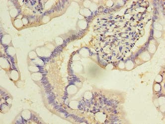 Polyclonal Rabbit anti-Human DENND2D Antibody (WB)
