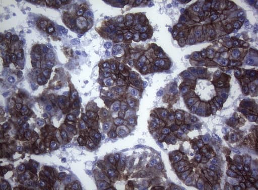 SYNC / SYNCOILIN Antibody (clone OTI5B8)