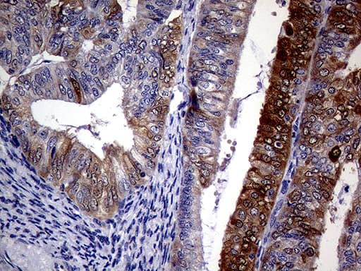 p16INK4a / CDKN2A Antibody (clone OTI11D3)