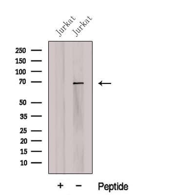 CCDC120 Antibody