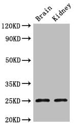 CLDN10 / Claudin 10 Antibody