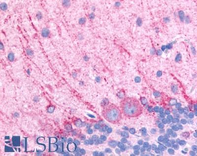 IHC-plus™ DRD5 / Dopamine Receptor D5 Antibody (Extracellular Domain)