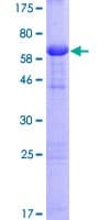 Human CALU / Calumenin Protein (Recombinant GST)