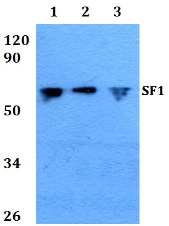 IHC-plus™ SF1 Antibody (aa45-98)